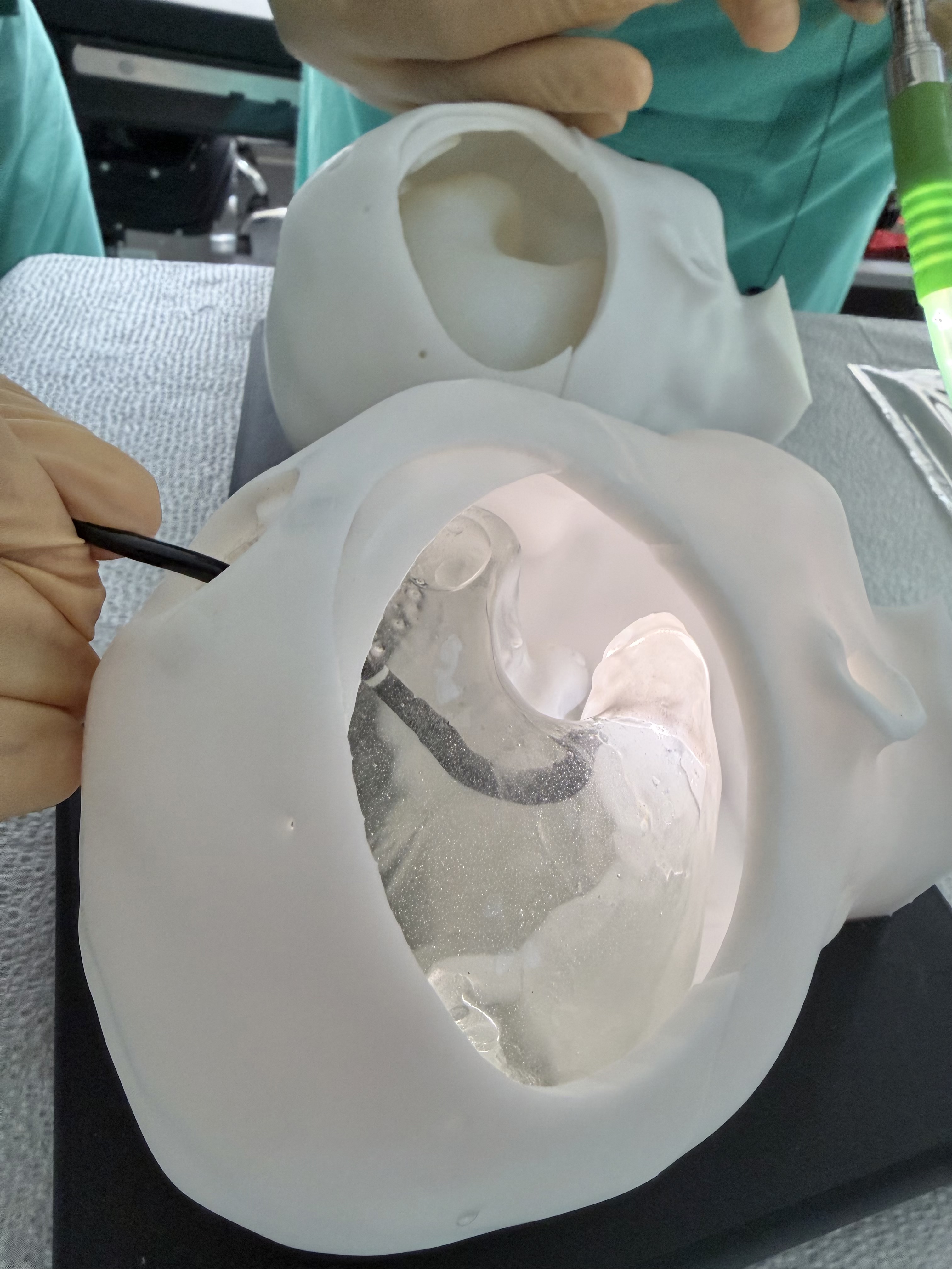 Endoscope entering a transparent 3D printed model of a child’s ventricles