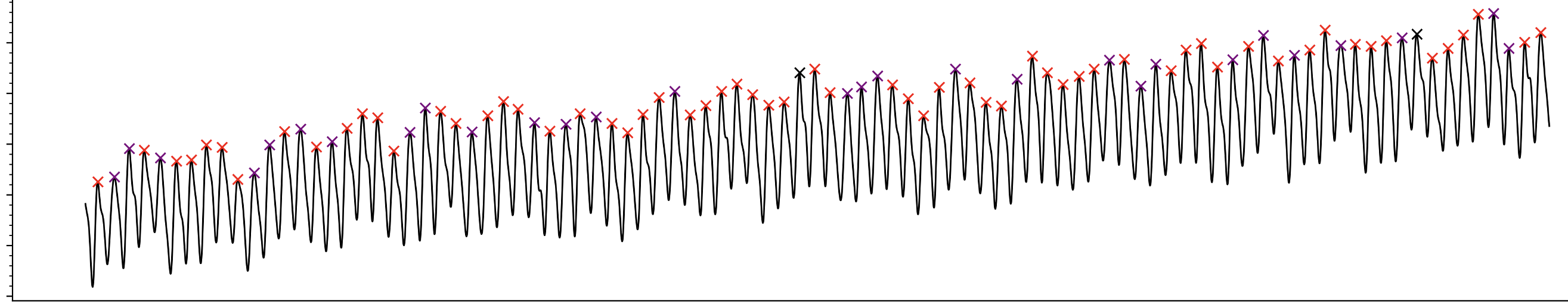 Intracranial pressure waveform trace with detected peaks marked